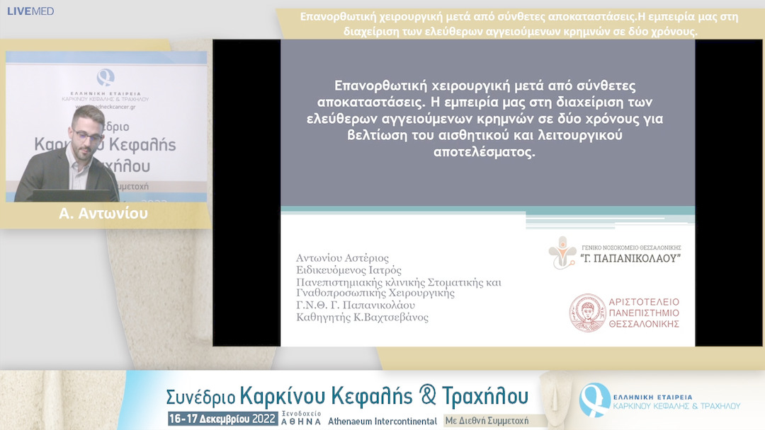 48 Α. Αντωνίου - Επανορθωτική χειρουργική μετά από σύνθετες αποκαταστάσεις. Η εμπειρία μας στη διαχείριση των ελεύθερων αγγειούμενων κρημνών σε δύο χρόνους.