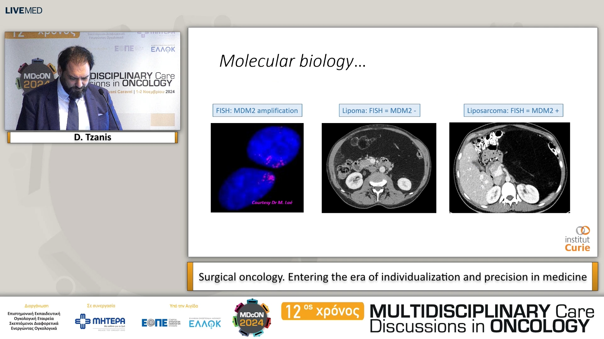 52 D. Tzanis - Surgical oncology. Entering the era of individualization and precision in medicine 
