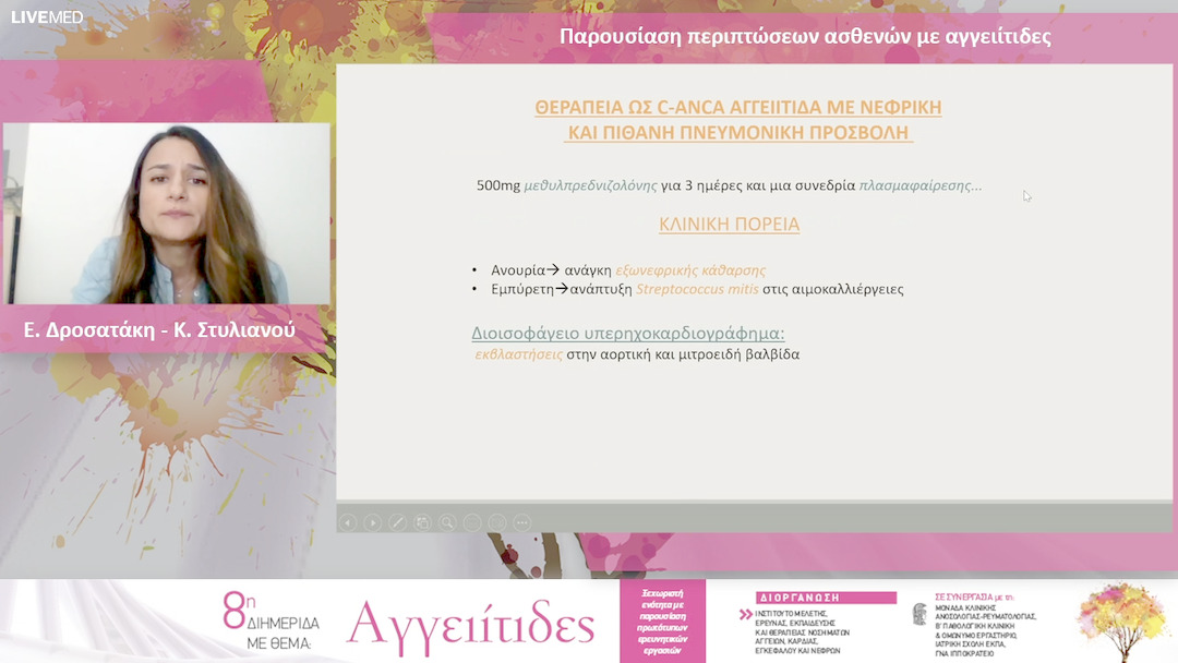 33 Ε. Δροσατάκη - Κ. Στυλιανού - Παρουσίαση περιπτώσεων ασθενών με αγγειίτιδες