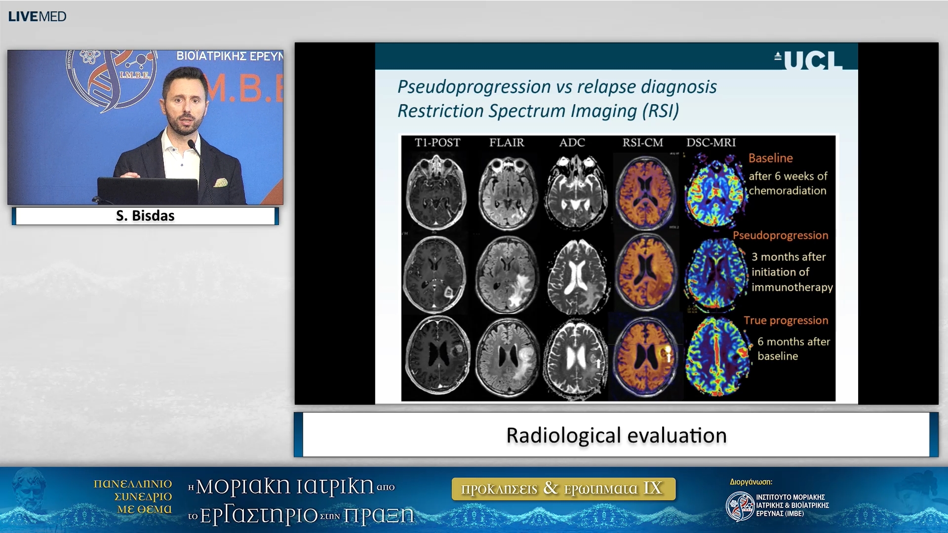 17 S. Bisdas - Radiological evaluation