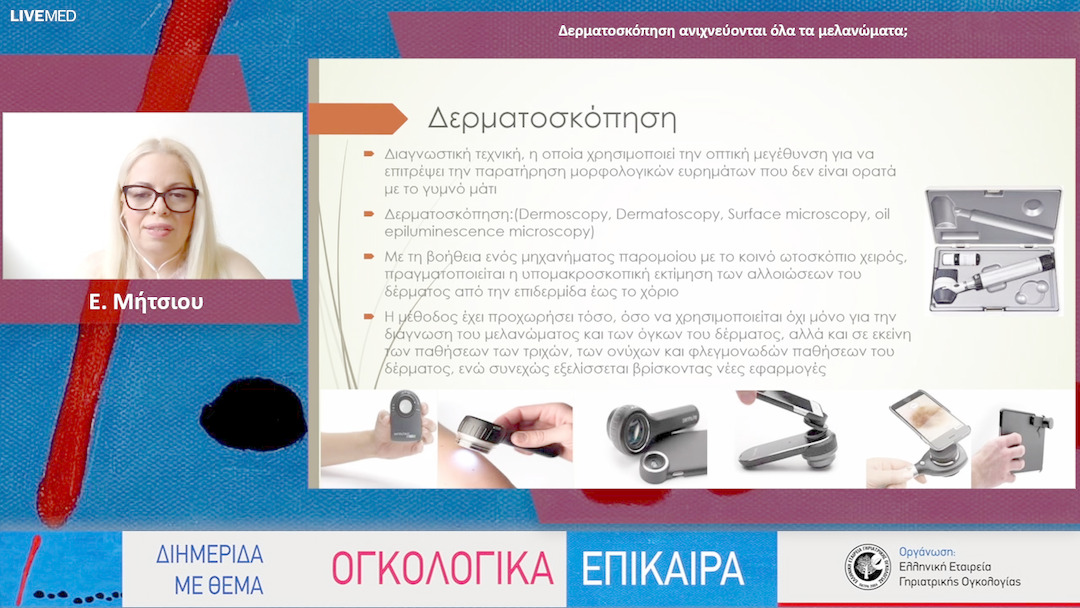 11 Ε. Μήτσιου - Δερματοσκόπηση ανιχνεύονται όλα τα μελανώματα;