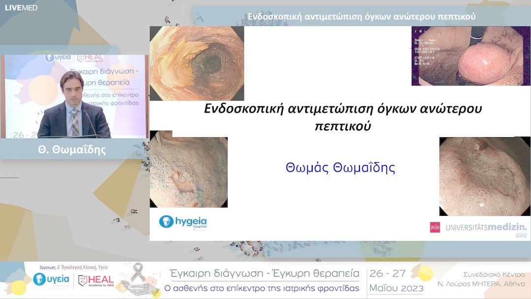 28 Θ. Θωμαΐδης - Ενδοσκοπική αντιμετώπιση όγκων ανώτερου πεπτικού