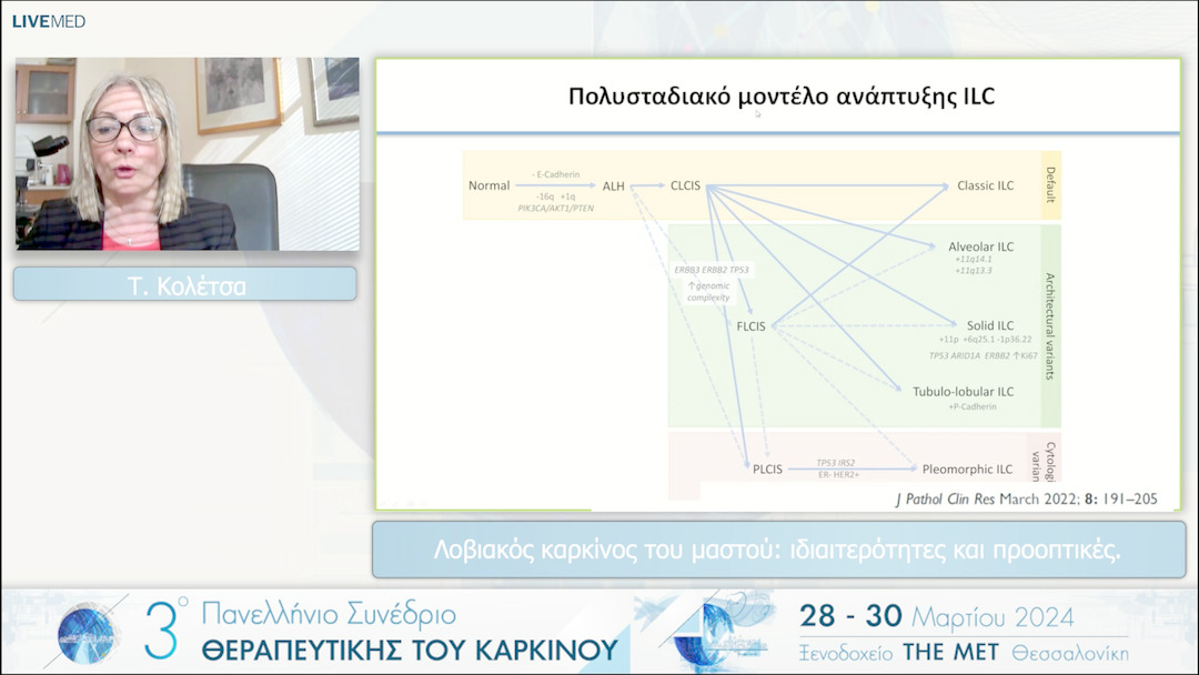 26 Τ. Κολέτσα - Λοβιακός καρκίνος του μαστού: ιδιαιτερότητες και προοπτικές. 