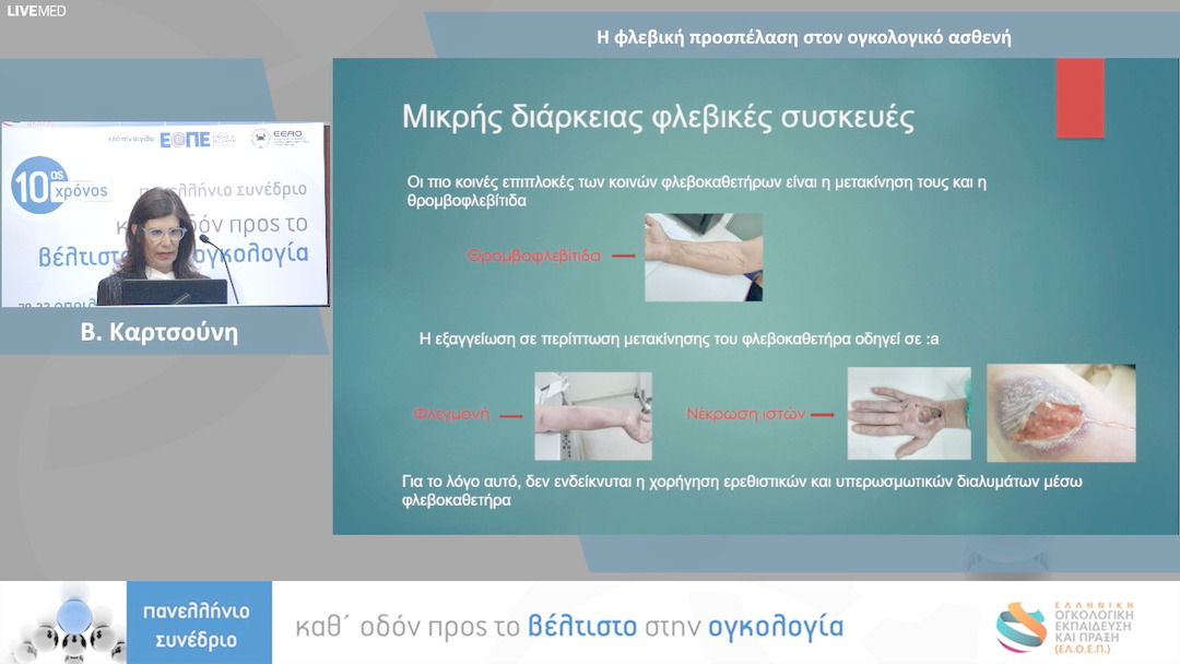 59 Β. Καρτσούνη - Η φλεβική προσπέλαση στον ογκολογικό ασθενή