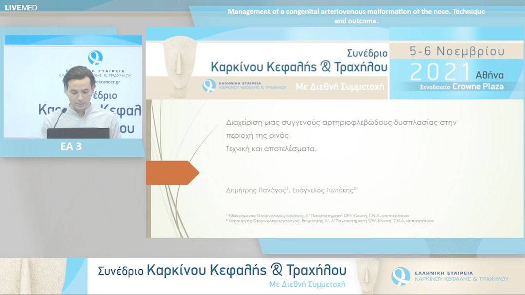 45 Δ. Πανάγος - Management of a congenital arteriovenous malformation of the nose. Technique and outcome.