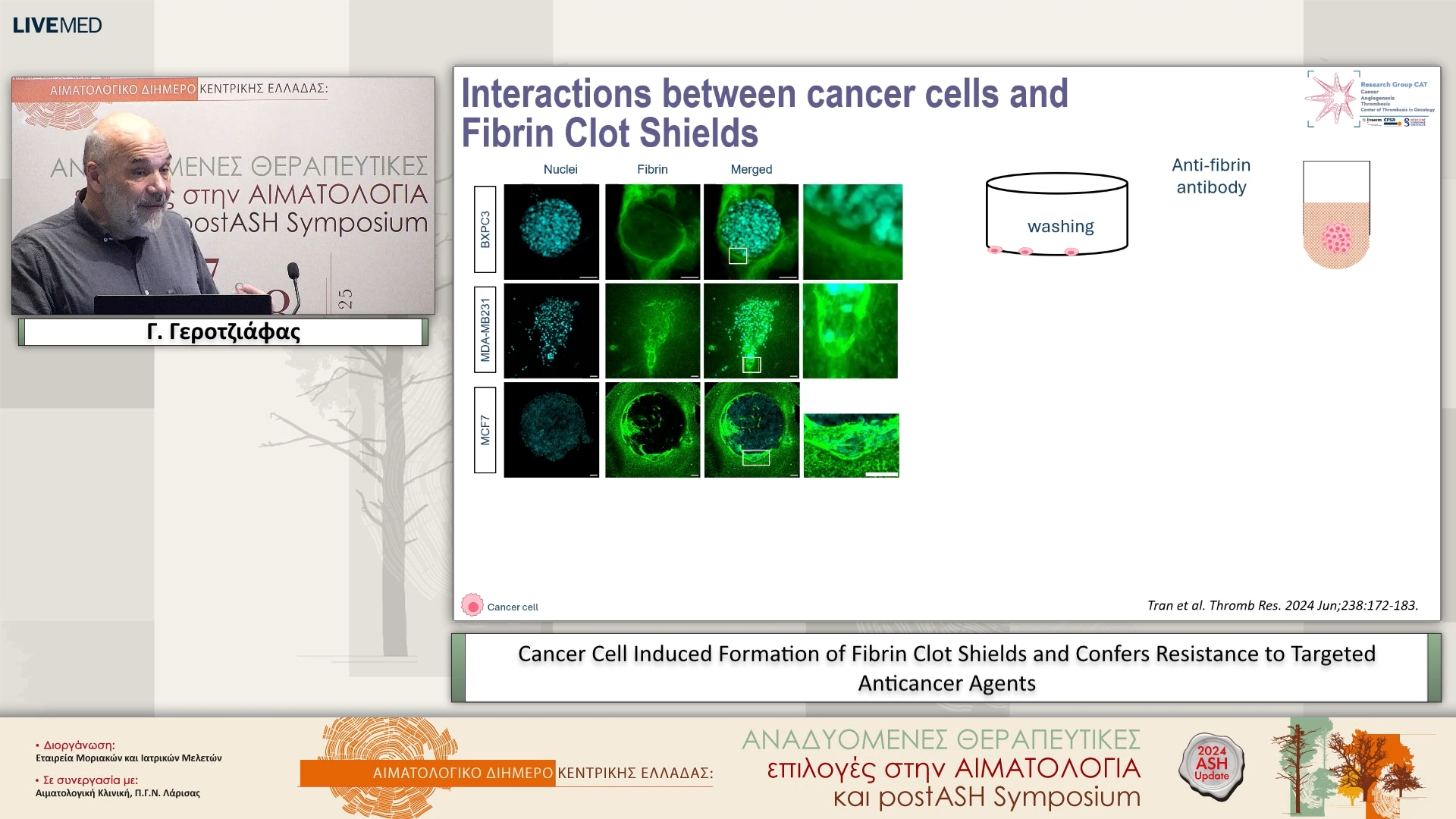 49 Γ. Γεροτζιάφας - Cancer Cell Induced Formation of Fibrin Clot Shields and Confers Resistance to Targeted Anticancer Agents