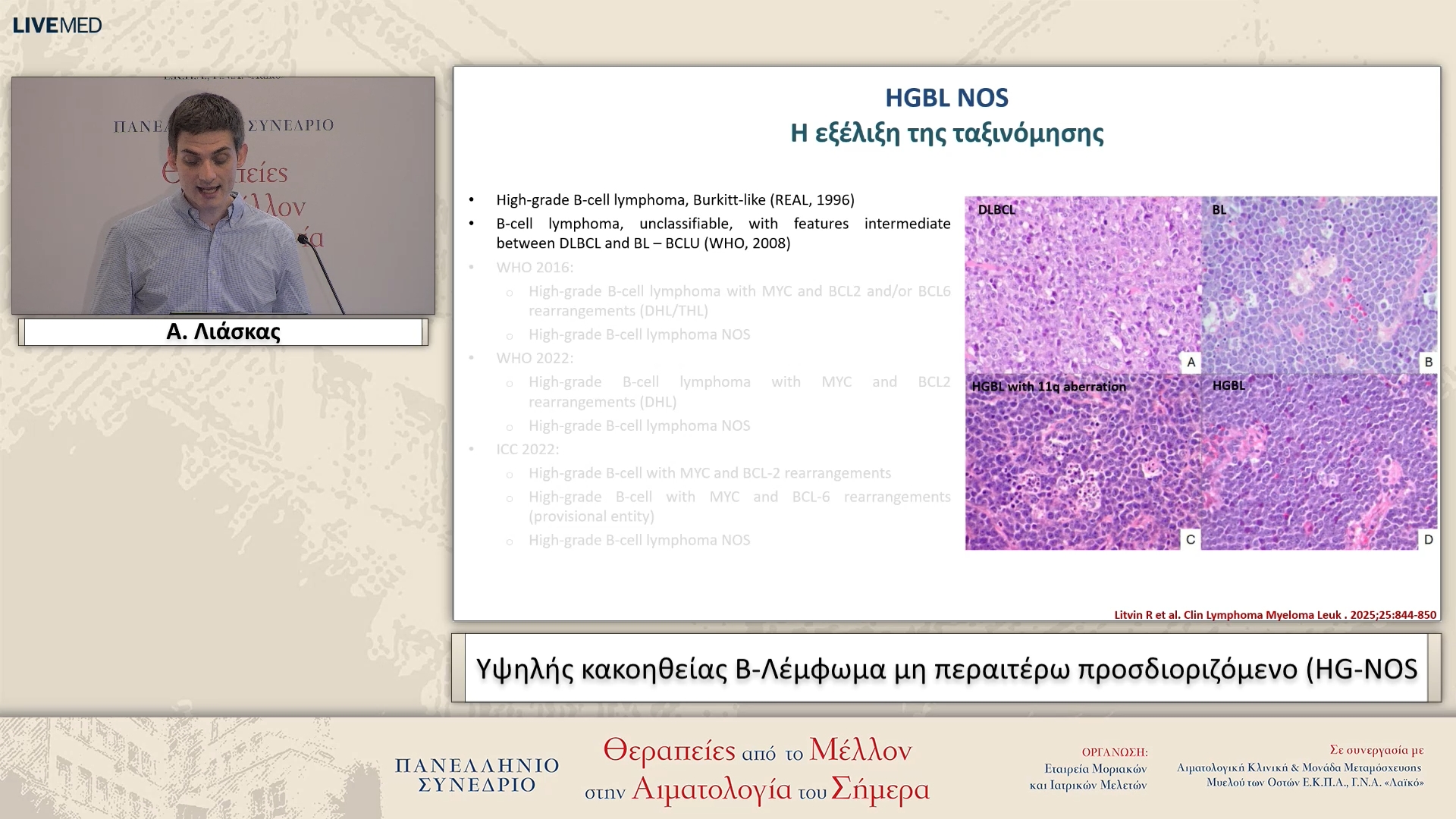 37 Α. Λιάσκας - Υψηλής κακοηθείας Β-Λέμφωμα μη περαιτέρω προσδιοριζόμενο (HG-NOS)