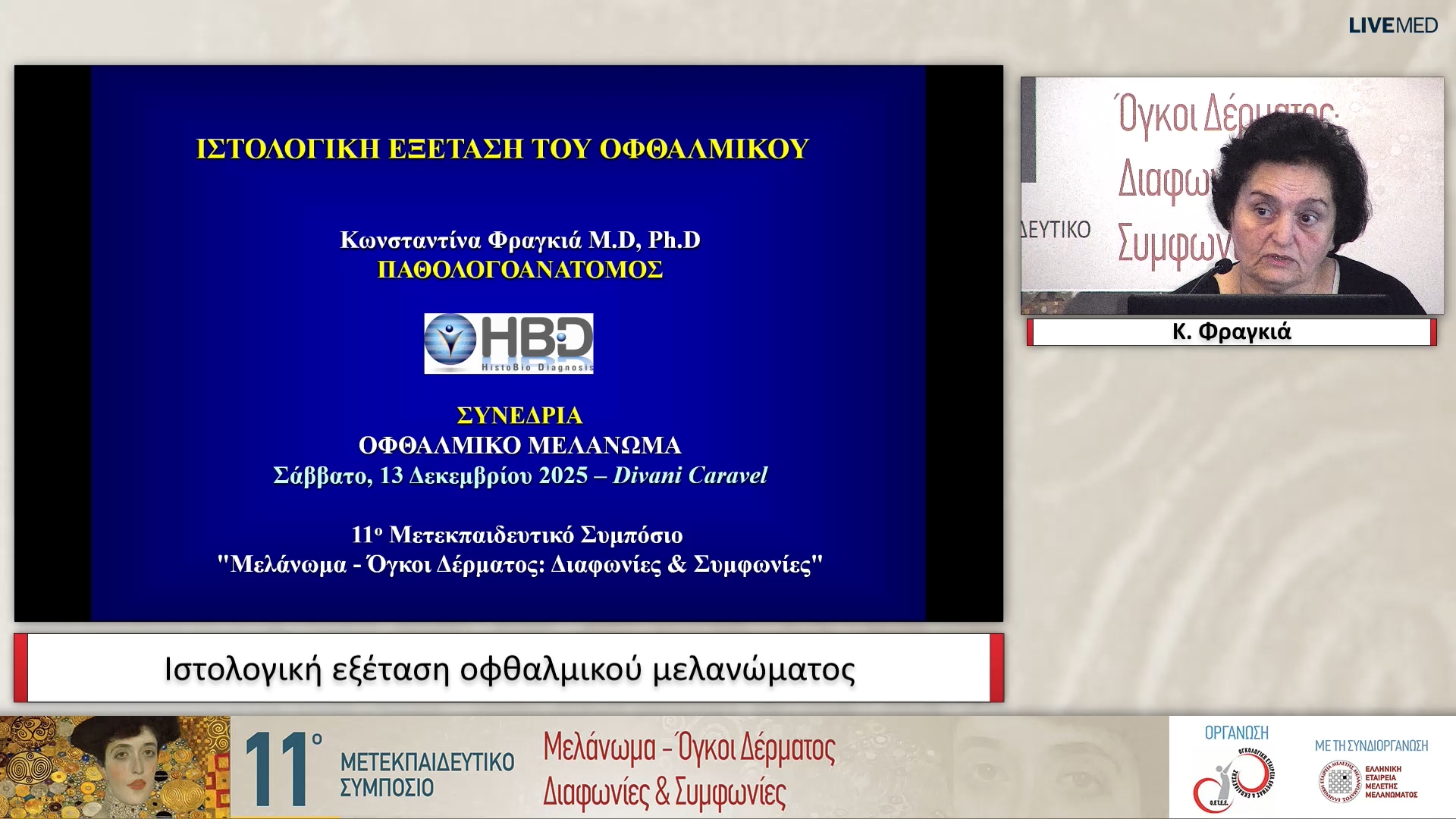 31 Κ. Φραγκιά - Ιστολογική εξέταση οφθαλμικού μελανώματος