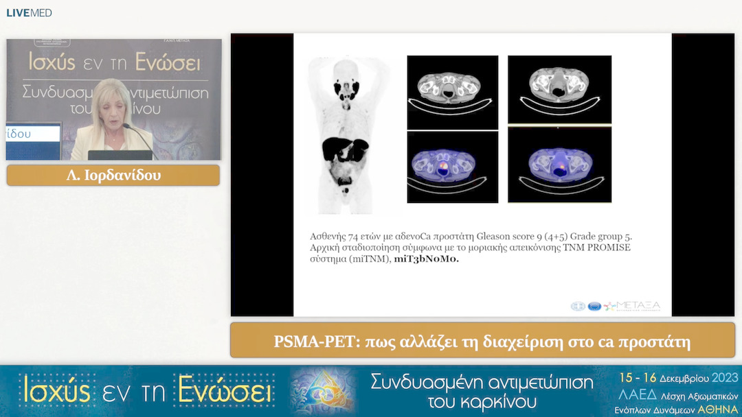51 Λ. Ιορδανίδου - PSMA-PET: πως αλλάζει τη διαχείριση στο ca προστάτη 