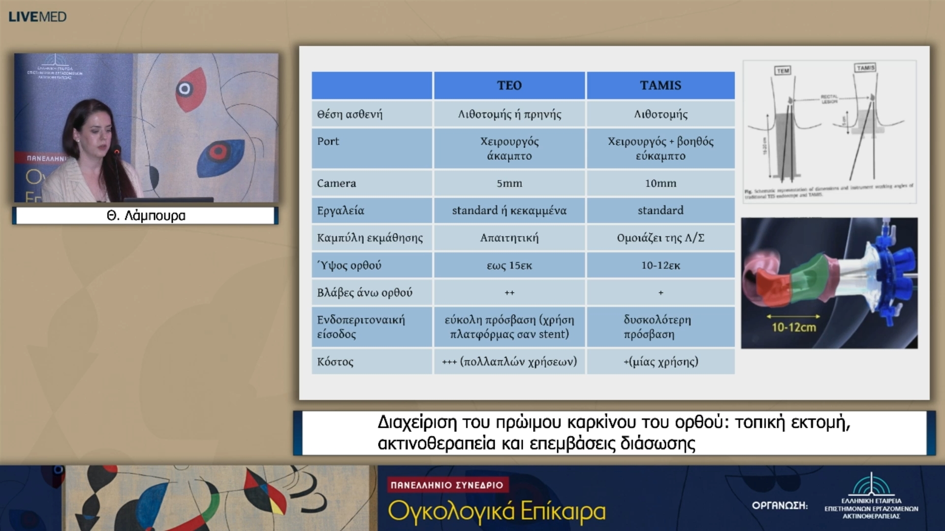 44 Θ. Λάμπουρα - Διαχείριση του πρώιμου καρκίνου του ορθού: τοπική εκτομή, ακτινοθεραπεία και επεμβάσεις διάσωσης 