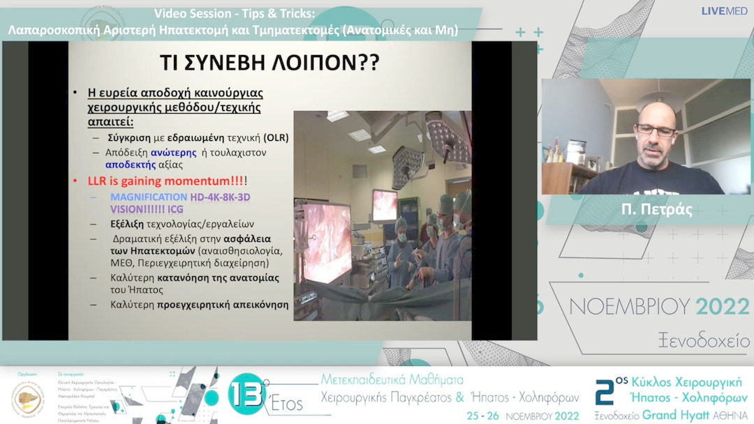 12 Π. Πετράς - Video Session - Tips & Tricks: Λαπαροσκοπική Αριστερή Ηπατεκτομή καιΤμηματεκτομές (Ανατομικές και Μη)