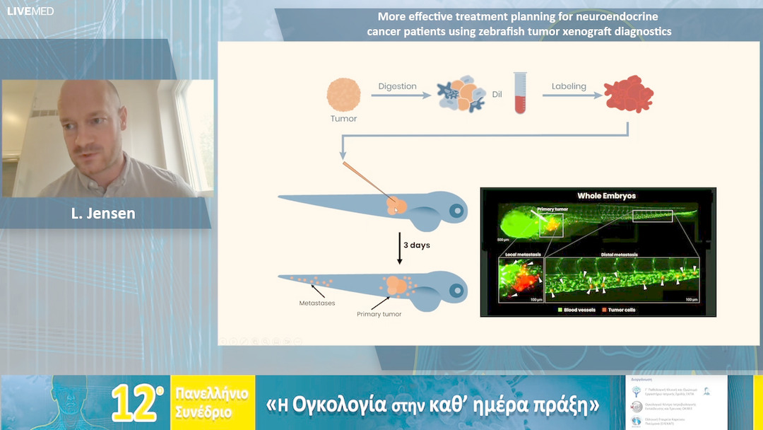38 L. Jensen - More effective treatment planning for neuroendocrine cancer patients using zebrafish tumor xenograft diagnostics