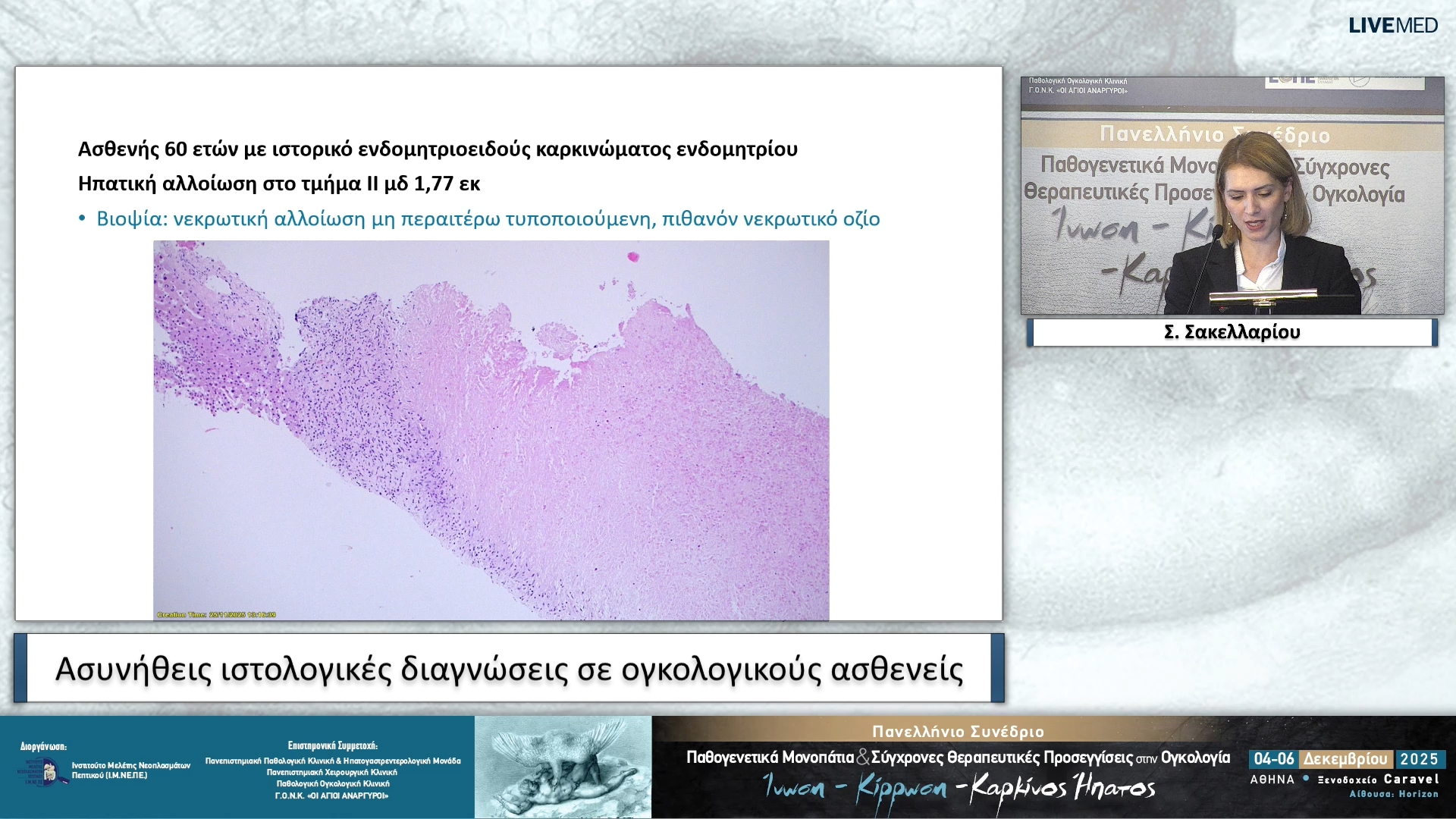 39 Σ. Σακελλαρίου - Ασυνήθεις ιστολογικές διαγνώσεις σε ογκολογικούς ασθενείς