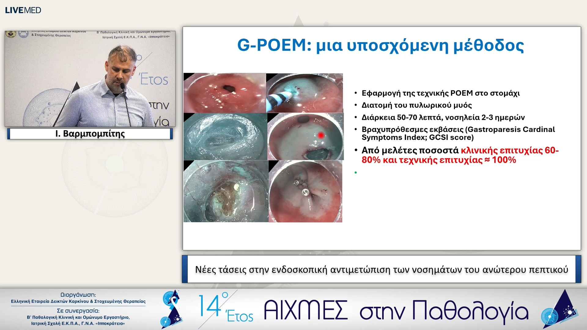 39 Ι. Βαρμπομπίτης - Νέες τάσεις στην ενδοσκοπική αντιμετώπιση των νοσημάτων του ανώτερου πεπτικού