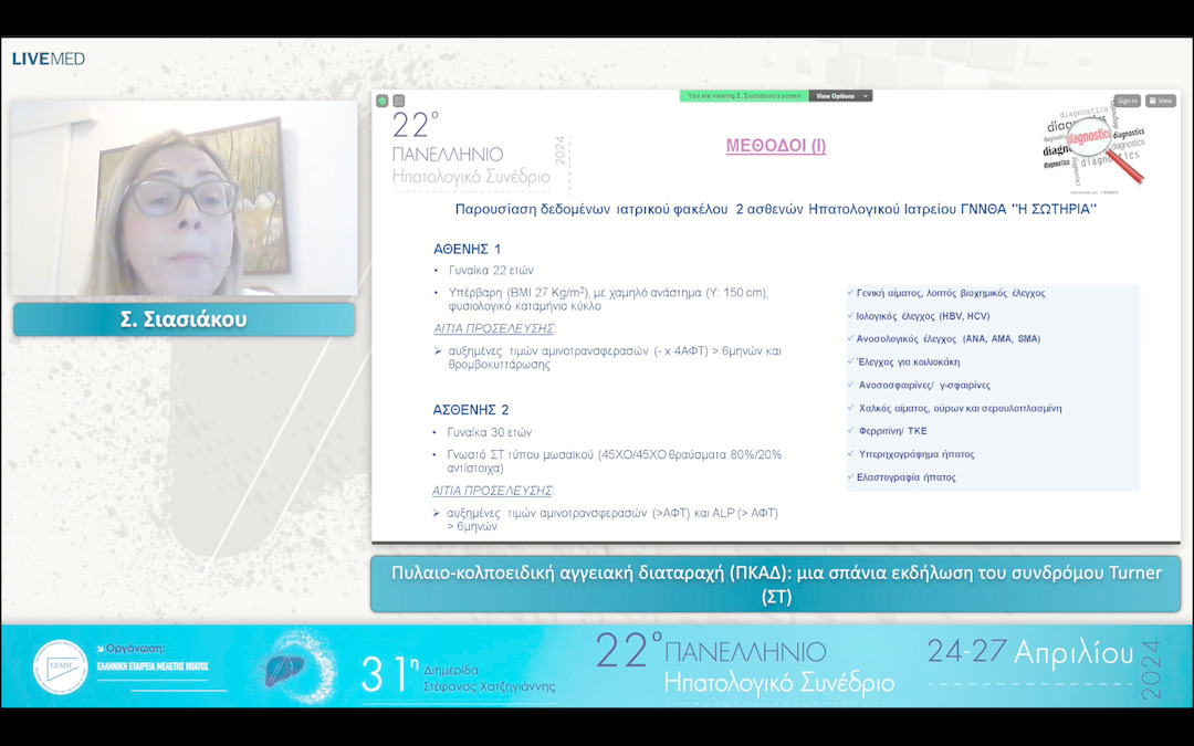 33 Σ. Σιασιάκου - Πυλαιο-κολποειδική αγγειακή διαταραχή (ΠΚΑΔ): μια σπάνια εκδήλωση του συνδρόμου Turner (ΣΤ)