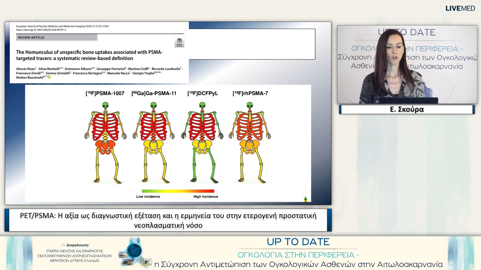 25 Ε. Σκούρα - PET/PSMA: Η αξία ως διαγνωστική εξέταση και η ερμηνεία του στην ετερογενή προστατική νεοπλασματική νόσο